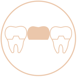 Dental Bridges